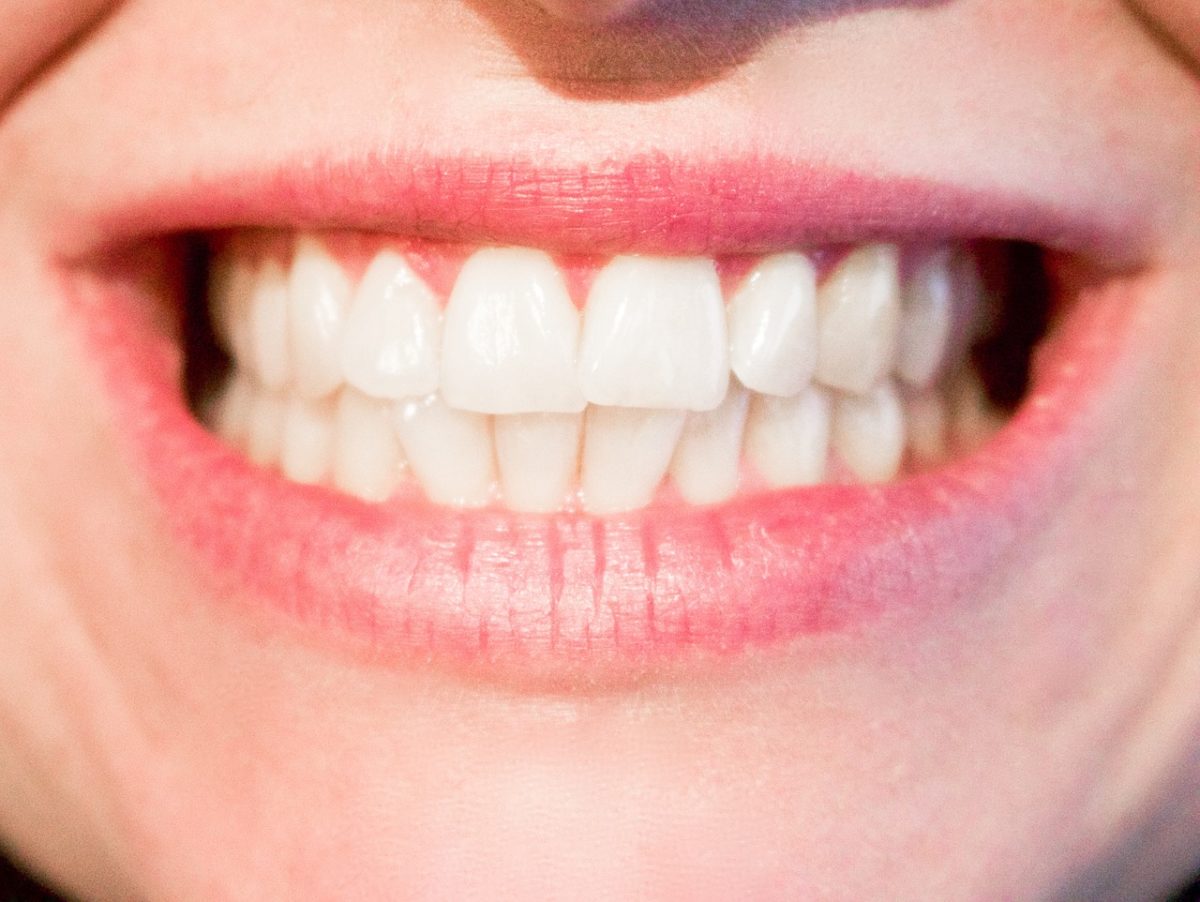Dzisiejsza technika stosowana w salonach stomatologii estetycznej zdoła spowodować, że odzyskamy prześliczny uśmiech.